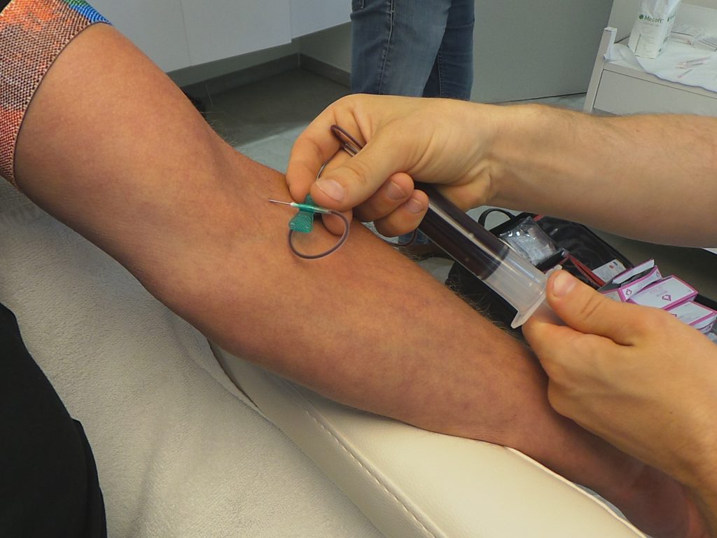 Prp Haarbehandeling
